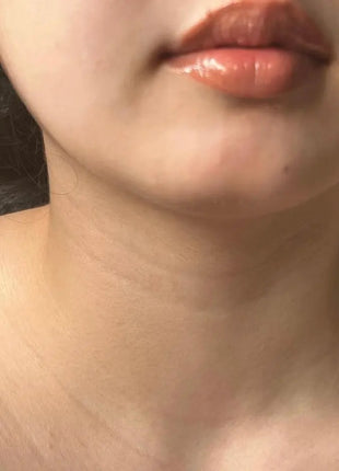 Mole